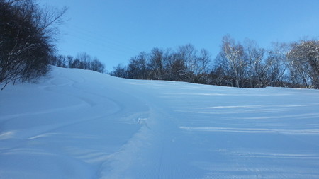 20180317_075902