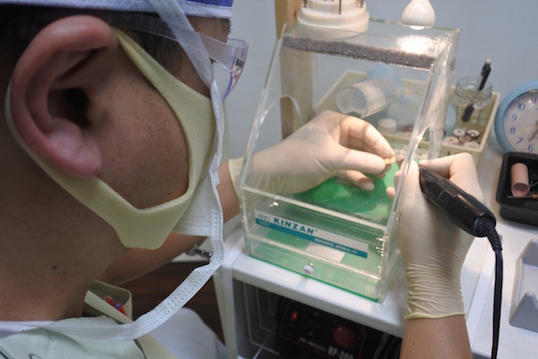 私の大切な前歯もきれいにお手入れしていただきました。